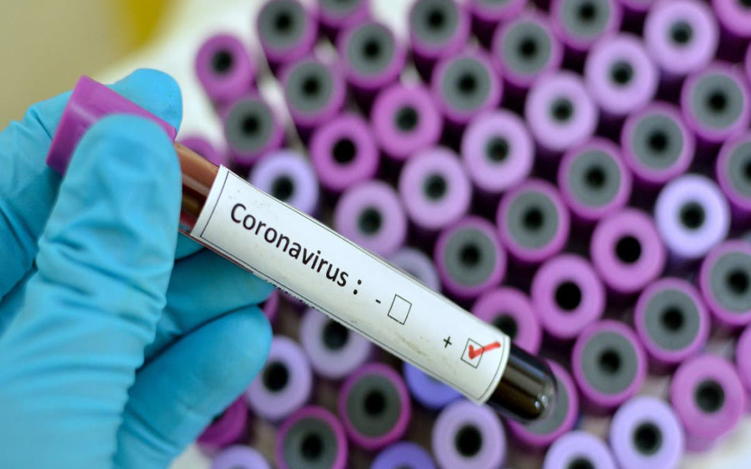 وزارة الصحة الإيرانية: تسجيل 881 إصابة جديدة بفيروس كورونا خلال 24 ساعة الماضية