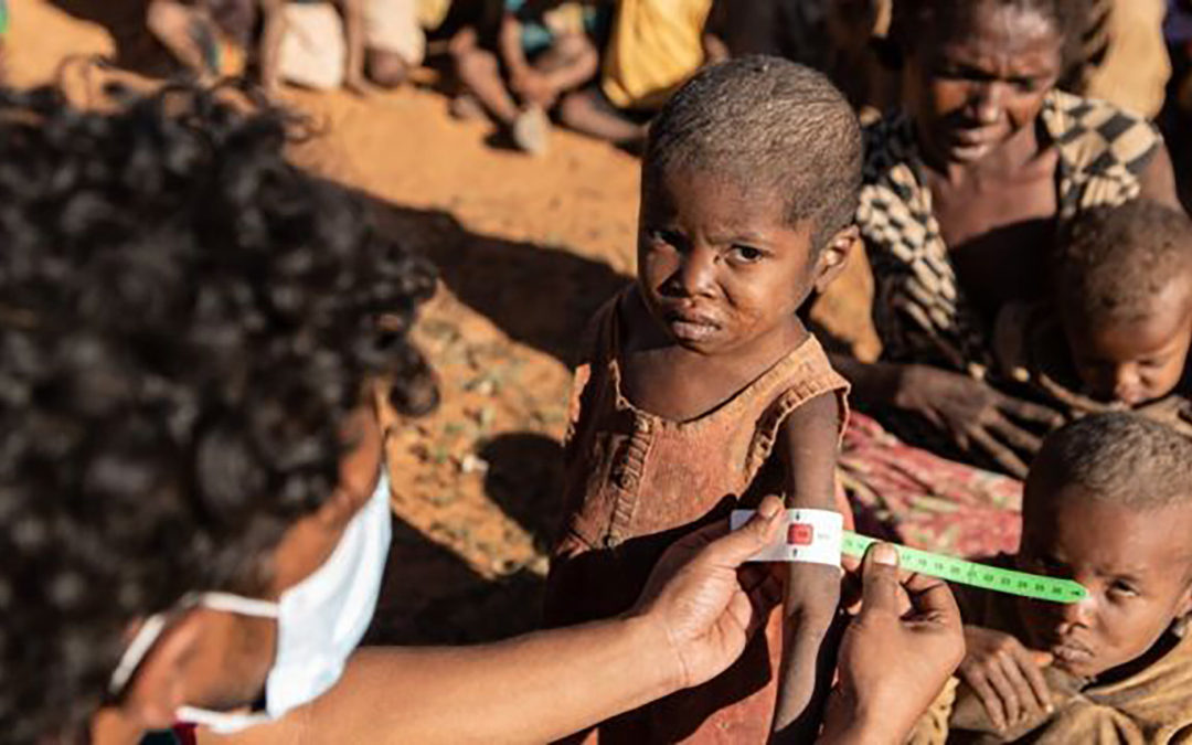 الأمم المتحدة تدق ناقوس الخطر 13 مليون شخص يواجهون خطر المجاعة في القرن الأفريقي