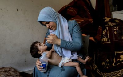 “وفا “: الأمم المتحدة: سوء التغذية الحاد بين الأطفال بغزة وصل أعلى مستوى